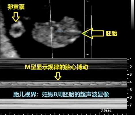 胎儿系统超声检查(胎儿三级超声检查是什么) 第1张 胎儿系统超声检查(胎儿三级超声检查是什么) 第1张