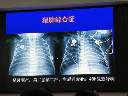ct对胎儿有影响吗(婴儿做CT有副作用吗) 第2张 ct对胎儿有影响吗(婴儿做CT有副作用吗) 第2张
