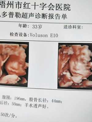 四维胎儿不配合(四维胎儿不配合) 第2张 四维胎儿不配合(四维胎儿不配合) 第2张