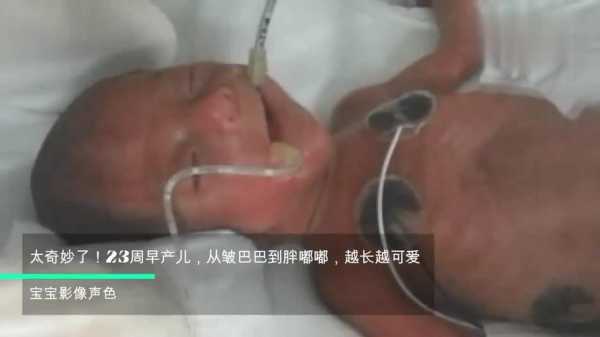 33周早产后遗症多吗,33周胎儿图片真人 第2张 33周早产后遗症多吗,33周胎儿图片真人 第2张
