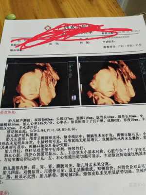 四维生育险能报多少,胎儿四维多少钱照 第2张 四维生育险能报多少,胎儿四维多少钱照 第2张