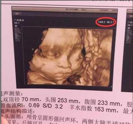 四维生育险能报多少,胎儿四维多少钱照 第3张 四维生育险能报多少,胎儿四维多少钱照 第3张