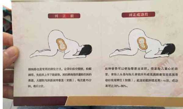 孕39周臀位,胎头在左上方,晚上睡觉应该怎么睡,39周胎儿头围标准值 第1张 孕39周臀位,胎头在左上方,晚上睡觉应该怎么睡,39周胎儿头围标准值 第1张