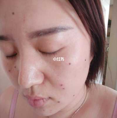 孕期可以点痣吗(孕期可以点痣吗脸上) 第1张 孕期可以点痣吗(孕期可以点痣吗脸上) 第1张