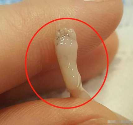火胎儿(火胎儿的影响) 第2张 火胎儿(火胎儿的影响) 第2张