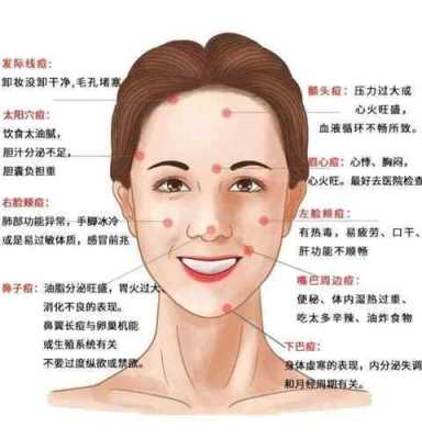 孕期脸上长痘怎么办(孕妇如何祛痘) 第2张 孕期脸上长痘怎么办(孕妇如何祛痘) 第2张