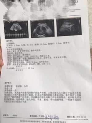 胎儿头偏大怎么办(35周胎儿头偏大怎么办) 第3张 胎儿头偏大怎么办(35周胎儿头偏大怎么办) 第3张