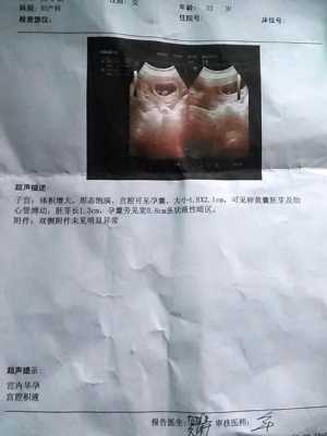 孕囊积液跟拉肚子有关吗,胎儿肠管积液是什么意思 第2张 孕囊积液跟拉肚子有关吗,胎儿肠管积液是什么意思 第2张