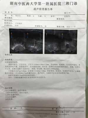 怀孕四十三天B超检查胎囊周围有液性暗区,该怎么办,孕期四周为一个月吗 第1张 怀孕四十三天B超检查胎囊周围有液性暗区,该怎么办,孕期四周为一个月吗 第1张