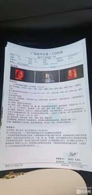胎儿肾集合系统分离(胎儿肾集合系统分离正常范围) 第3张 胎儿肾集合系统分离(胎儿肾集合系统分离正常范围) 第3张
