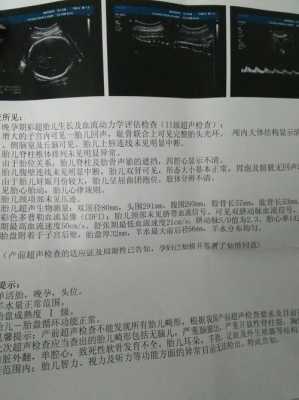 胎儿腿短是怎么回事?怎么补救啊,医生说胎儿腿短是什么意思 第1张 胎儿腿短是怎么回事?怎么补救啊,医生说胎儿腿短是什么意思 第1张