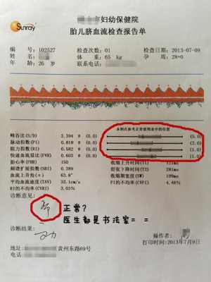 胎儿脐血流检查(孕24周脐血流隔多长时间检查一次?是不是这个要一周检查一次) 第2张 胎儿脐血流检查(孕24周脐血流隔多长时间检查一次?是不是这个要一周检查一次) 第2张