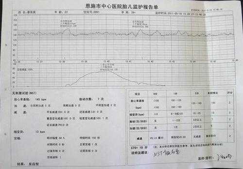 胎儿心率180(胎儿心率180左右意味着什么原因) 第2张 胎儿心率180(胎儿心率180左右意味着什么原因) 第2张