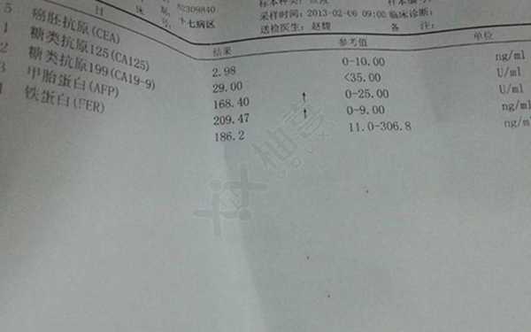 甲型胎儿蛋白(甲型胎儿蛋白什么意思) 第2张 甲型胎儿蛋白(甲型胎儿蛋白什么意思) 第2张