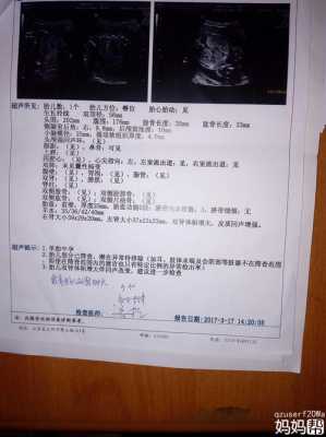 胎儿双肾偏大(胎儿双肾偏大) 第2张 胎儿双肾偏大(胎儿双肾偏大) 第2张