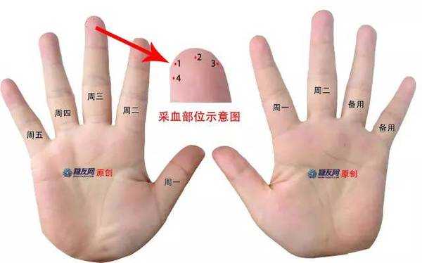 孕妇如何检测血糖？要抽血吗？还是扎手指就可以了,孕期抽血检查需要空腹吗  第1张