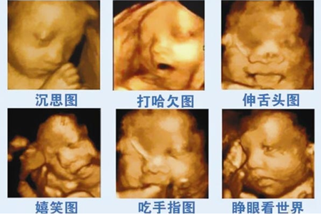 孕期做几次四维(孕期做几次四维彩超检查) 第2张 孕期做几次四维(孕期做几次四维彩超检查) 第2张