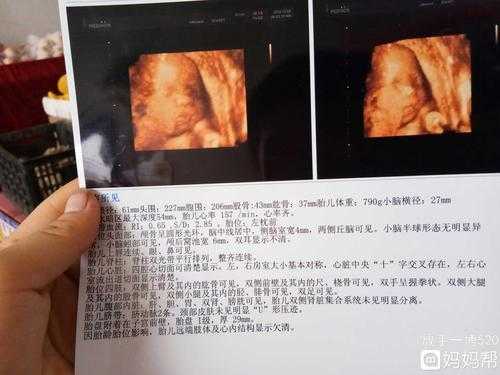孕早期胎儿偏小(孕早期胎儿偏小一周正常吗) 第2张 孕早期胎儿偏小(孕早期胎儿偏小一周正常吗) 第2张