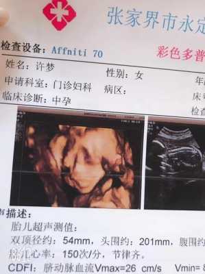 33周小朋友一般多重,33周胎儿多重正常  第2张