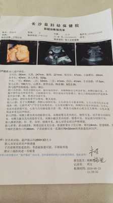 双肾实质及窦区点片状强回声什么意思,胎儿双肾回声增强是什么意思 第2张 双肾实质及窦区点片状强回声什么意思,胎儿双肾回声增强是什么意思 第2张