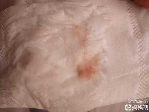孕期白带乳白色(怀孕有淡粉色白带怎么回事) 第2张 孕期白带乳白色(怀孕有淡粉色白带怎么回事) 第2张