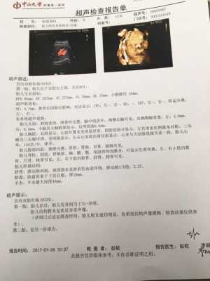 怀孕32周，想咨询一下宝宝大概有多大,32周胎儿大小正常范围  第3张