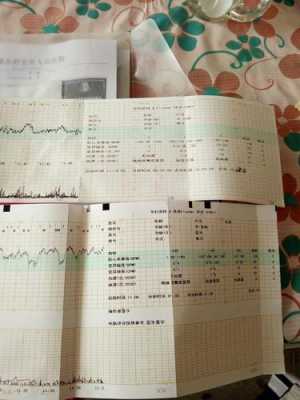 胎儿心跳180（胎儿心跳180正常吗）  第1张