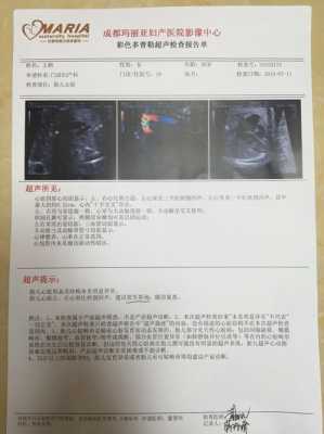胎儿右心室强回声(胎儿右心室强回声是什么意思) 第1张 胎儿右心室强回声(胎儿右心室强回声是什么意思) 第1张