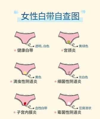 孕期白带多怎么办(孕妇白带多正常吗) 第1张 孕期白带多怎么办(孕妇白带多正常吗) 第1张