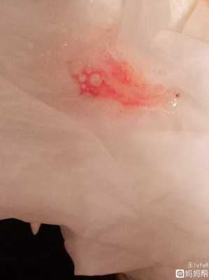 孕妇呕吐出血是怎么回事,孕期拉血怎么回事女性 第2张 孕妇呕吐出血是怎么回事,孕期拉血怎么回事女性 第2张