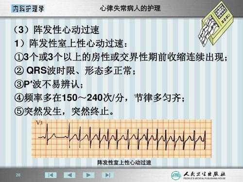 胎儿心率失常（胎儿心率失常是什么原因引起的）  第2张