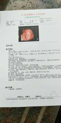胎儿胃泡小(胎儿胃泡小是怎么回事) 第2张 胎儿胃泡小(胎儿胃泡小是怎么回事) 第2张