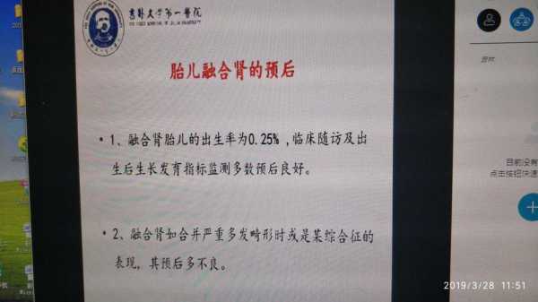 融合肾是什么意思,胎儿融合肾是什么意思  第2张