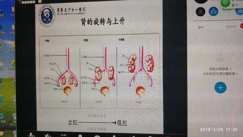 融合肾是什么意思,胎儿融合肾是什么意思  第1张
