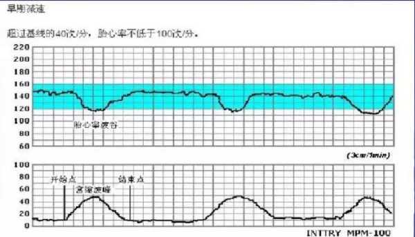 胎儿心率过高(胎心监护心率过高原因都有哪些了的啊) 第2张 胎儿心率过高(胎心监护心率过高原因都有哪些了的啊) 第2张