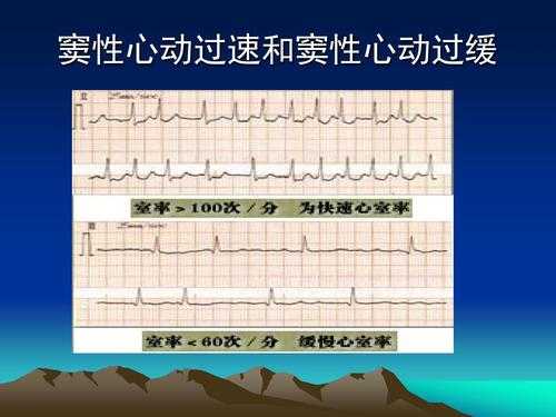 胎儿心动过缓(胎儿心动过缓的原因有哪些) 第2张 胎儿心动过缓(胎儿心动过缓的原因有哪些) 第2张