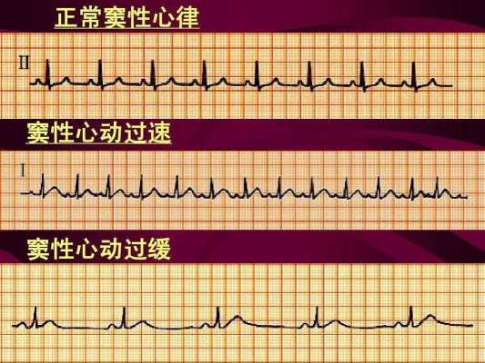 胎儿心动过缓(胎儿心动过缓的原因有哪些) 第1张 胎儿心动过缓(胎儿心动过缓的原因有哪些) 第1张