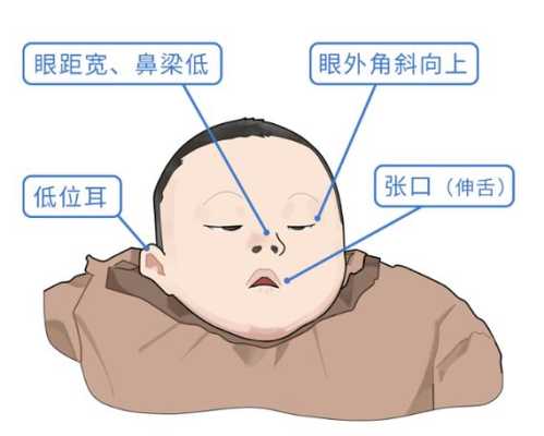 胎儿nt是什么意思（b超单上nt是什么意思，有什么特殊意义吗）  第3张