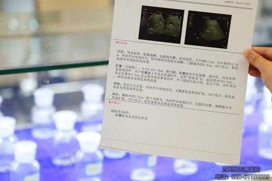 胎儿巨结肠(胎儿巨结肠B超可以检查出来吗) 第1张 胎儿巨结肠(胎儿巨结肠B超可以检查出来吗) 第1张
