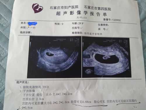 孕早期出血,可以做阴超吗,孕期可以做阴超吗有没有危险 第2张 孕早期出血,可以做阴超吗,孕期可以做阴超吗有没有危险 第2张
