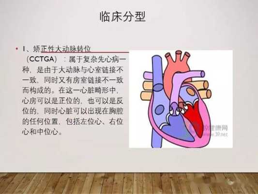 胎儿大动脉转位(胎儿大动脉转位是第几周形成的) 第2张 胎儿大动脉转位(胎儿大动脉转位是第几周形成的) 第2张