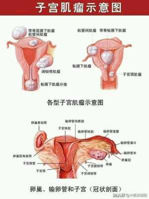 子宫肌瘤影响胎儿吗(孕妇子宫肌瘤影响胎儿吗) 第2张 子宫肌瘤影响胎儿吗(孕妇子宫肌瘤影响胎儿吗) 第2张