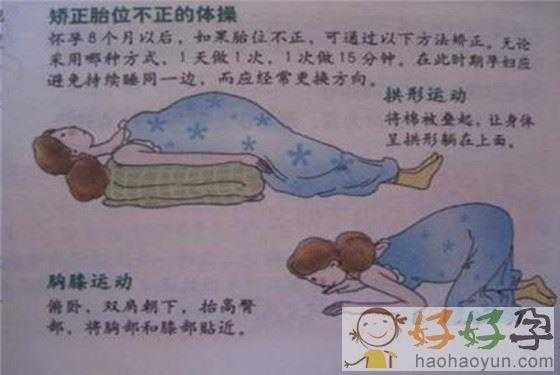 胎儿横位图片(孕37周,胎儿还是横位,怎么纠正) 第1张 胎儿横位图片(孕37周,胎儿还是横位,怎么纠正) 第1张
