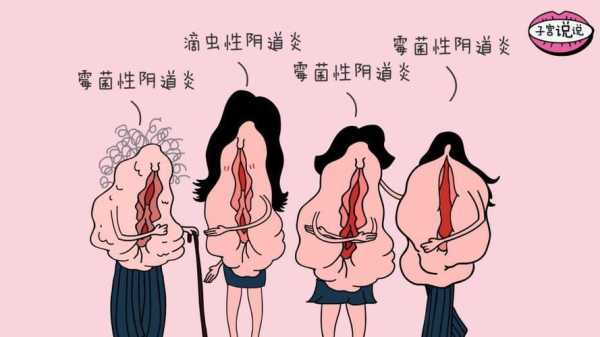 阴道炎影响胎儿吗 第2张 阴道炎影响胎儿吗 第2张
