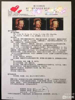 孕期排畸检查(孕期排畸检查都有哪些项目) 第3张 孕期排畸检查(孕期排畸检查都有哪些项目) 第3张