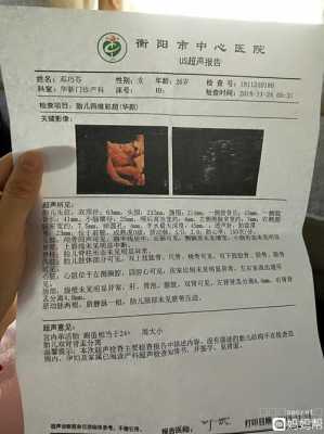 胎儿肾盂分离怎么办(胎儿肾盂分离怎么办好) 第2张 胎儿肾盂分离怎么办(胎儿肾盂分离怎么办好) 第2张