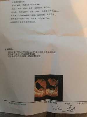 胎停原因是什么,胎儿胎停的原因有哪些 第2张 胎停原因是什么,胎儿胎停的原因有哪些 第2张