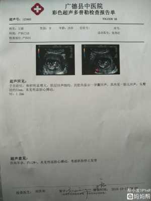 胎停原因是什么,胎儿胎停的原因有哪些 第3张 胎停原因是什么,胎儿胎停的原因有哪些 第3张