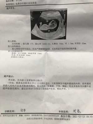 孕期检查都检查什么(孕妇做nt检查多少钱,NT检查是检查什么的) 第1张 孕期检查都检查什么(孕妇做nt检查多少钱,NT检查是检查什么的) 第1张