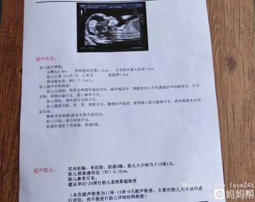 孕期检查都检查什么(孕妇做nt检查多少钱,NT检查是检查什么的) 第2张 孕期检查都检查什么(孕妇做nt检查多少钱,NT检查是检查什么的) 第2张